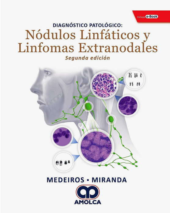 DIAGNOSTICO PATOLOGICO NODULOS LINFATICOS Y LINFOMAS EXTRANODALES